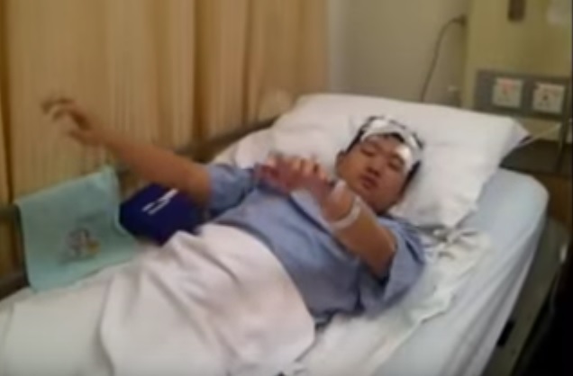 Therapy for Dystonia